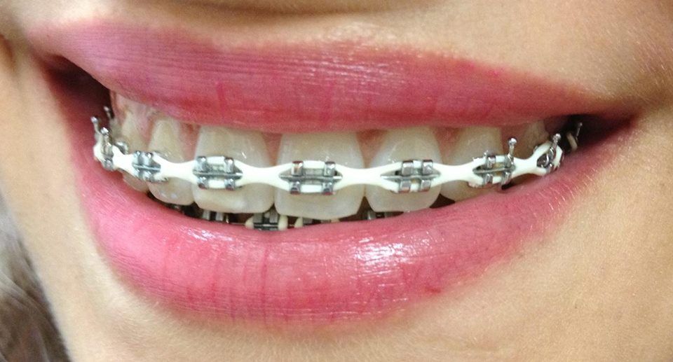 Infinity Care Dental - Miami Maintenance