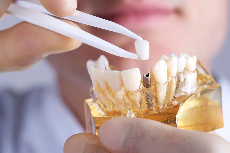 NO CONTENT - Sedation Dentistry of Sunny Isles Periodontics