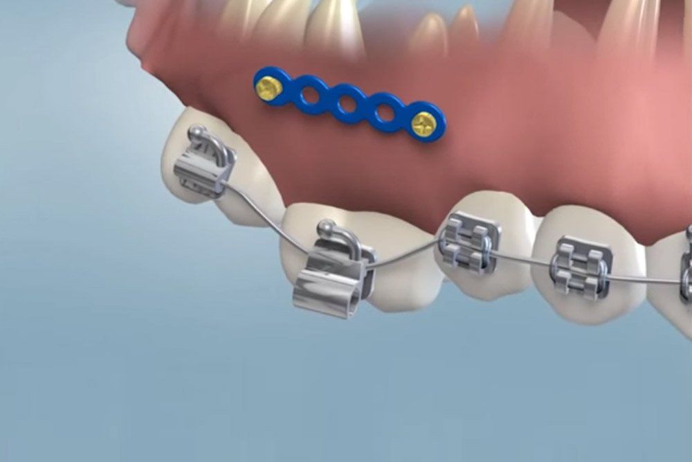 Moody Orthodontics Webpagedepot