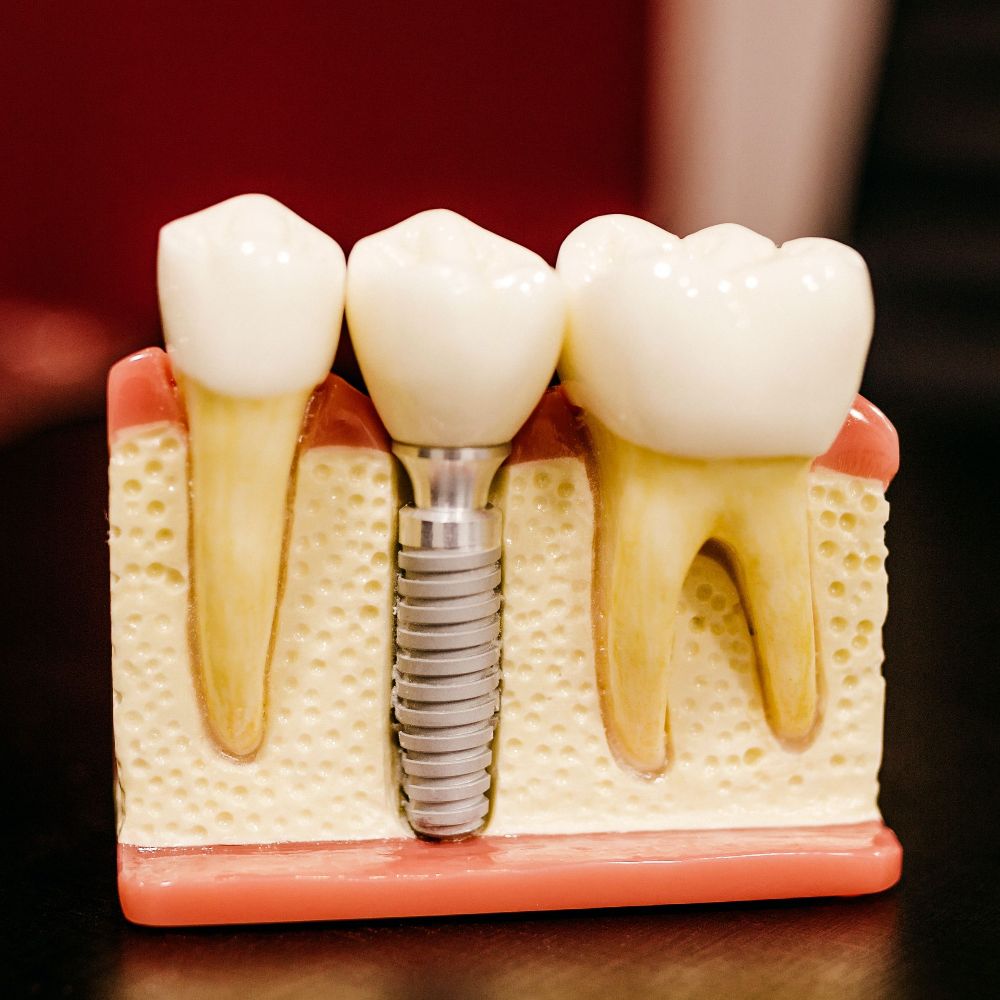 Nanuet Family Dentistryhttps: Webpagedepot
