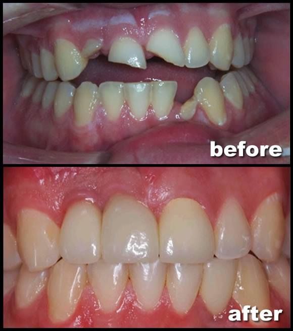 Riverside Dental Care - New York Shared(646)