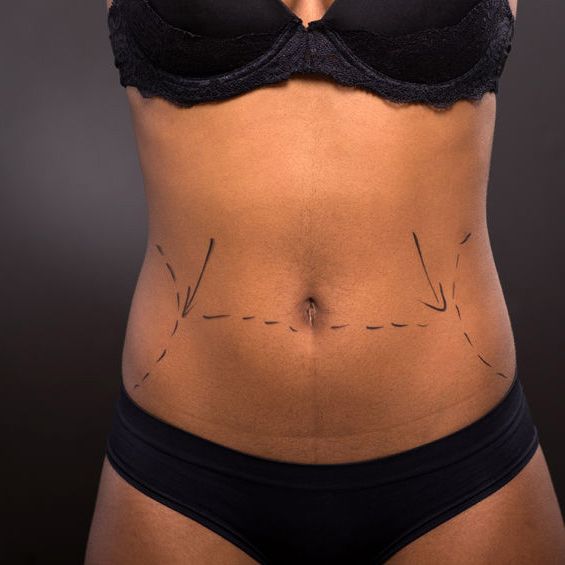 USA Plastic Surgery - Dallas Webpagedepot