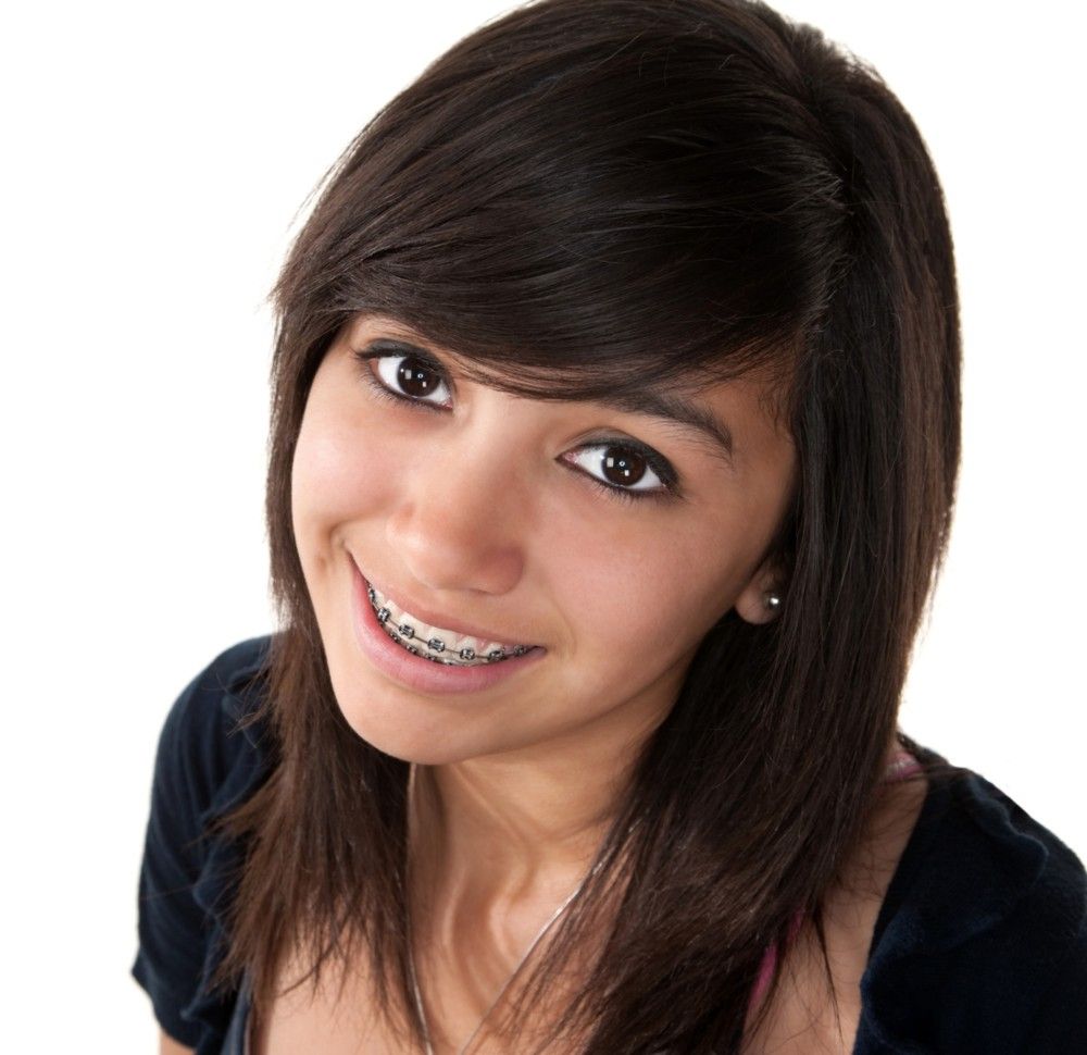 iSmiles Orthodontics - Irvine Professionals