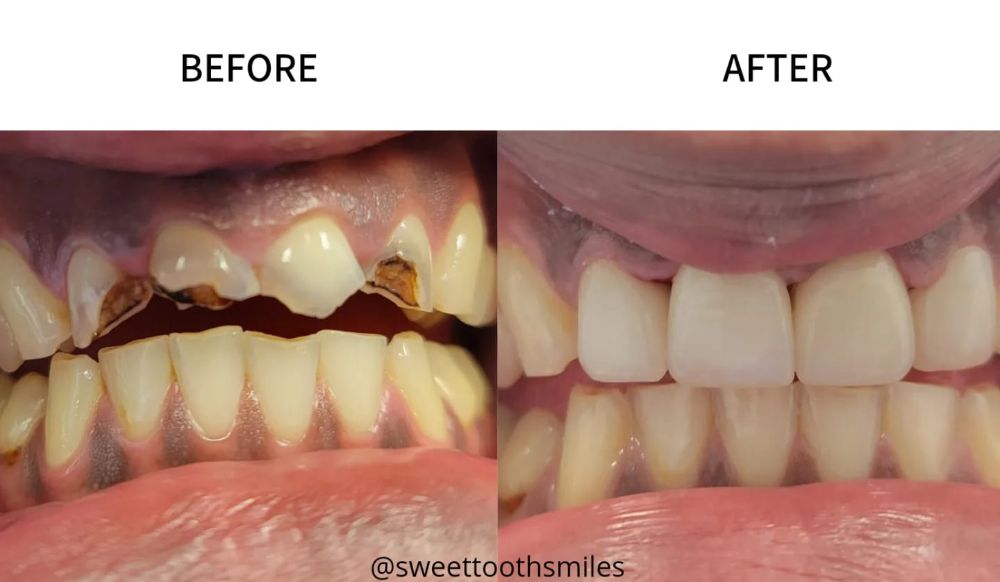 Sweet Tooth Smiles Dentistry and Orthodontics - Richmond Informative
