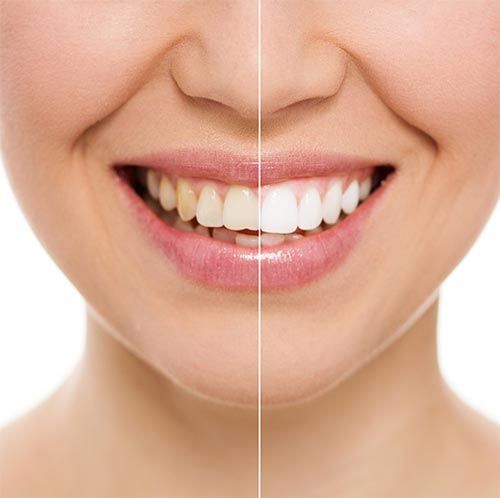 Putnam Bright Smile Dentistry - Brewster Informative