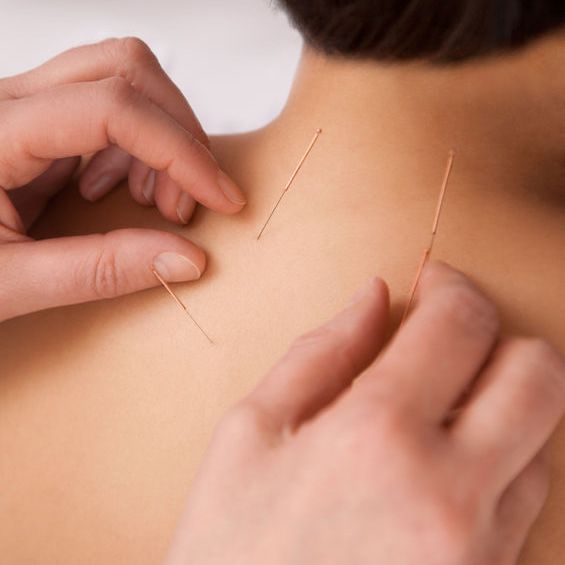 Complete Health Acupunctures