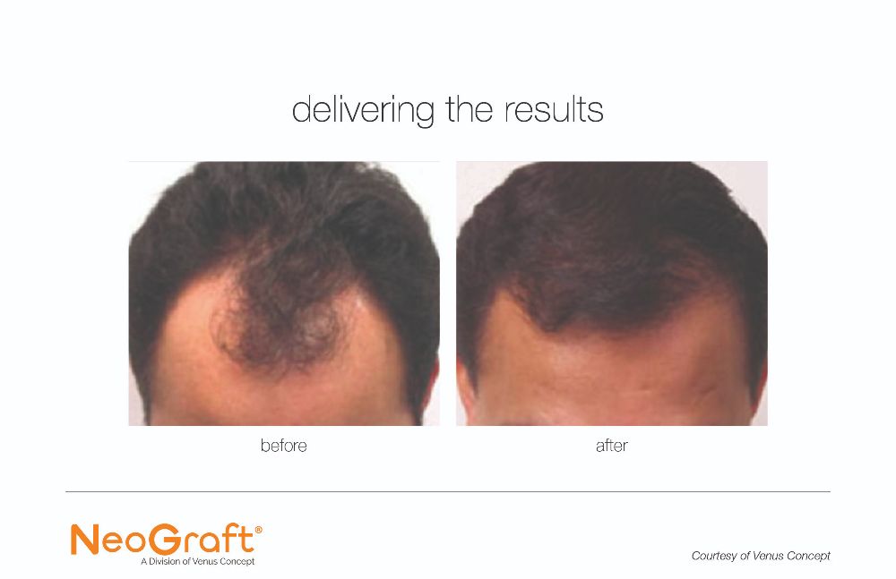 Brent Robinson, MD Plastic Surgery Webpagedepot