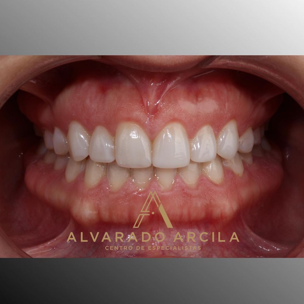 Alvarado Arcila Odontologia Especializada - Cartagena Especializada