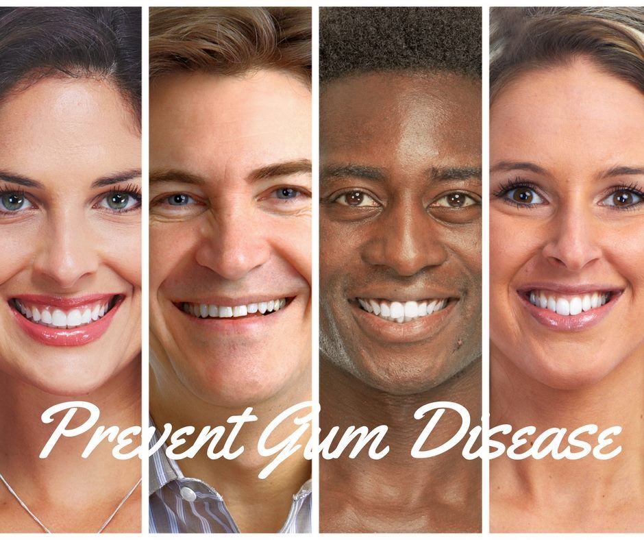 George T. Erbez, D.D.S. - Brentwood Combination