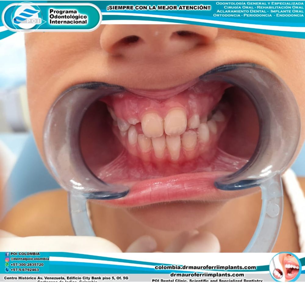 POI Dental Clinic - Cartagena Informative