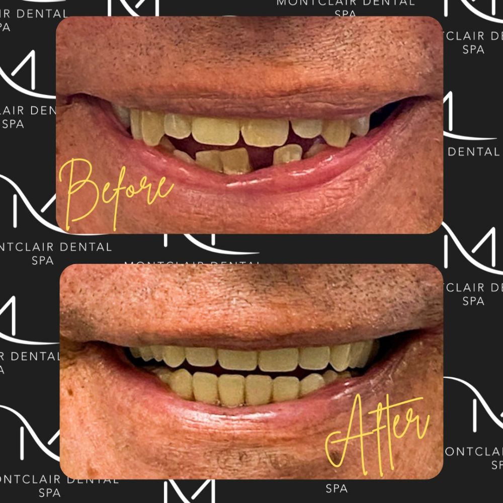 Montclair Dental Spa - Montclair Webpagedepot