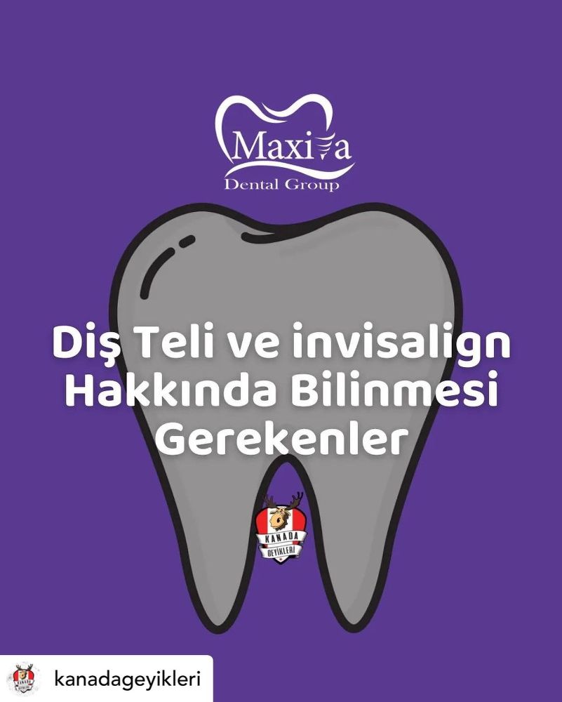 Maxilla Dental - Toronto Information