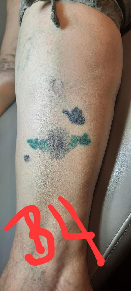 Ken's Tattoo Alley - St Peters Wheelchairs