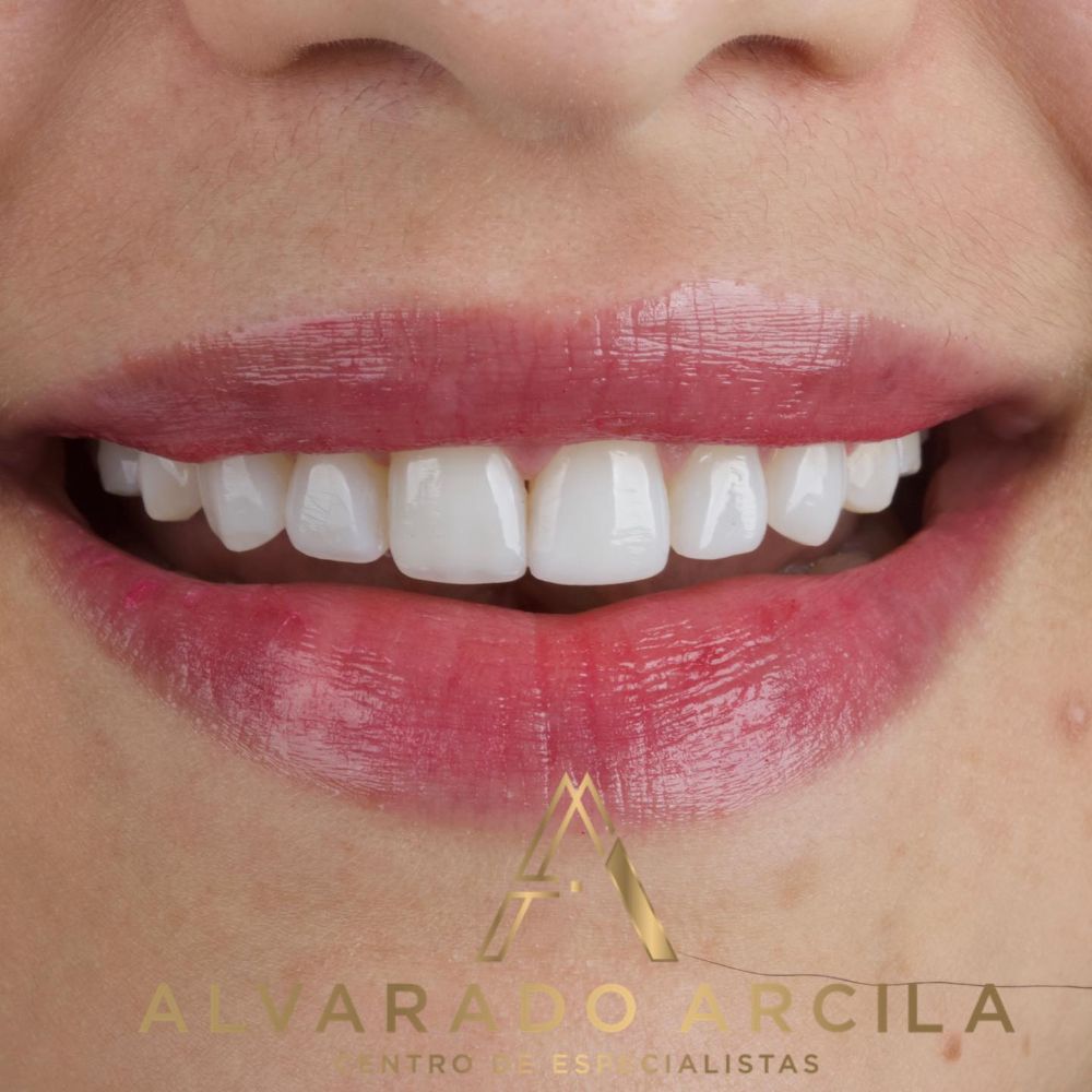 Alvarado Arcila Odontologia Especializada - Cartagena Wheelchairs