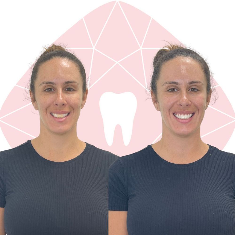 Adelaide Cosmetic Dentistry - Unley Combination