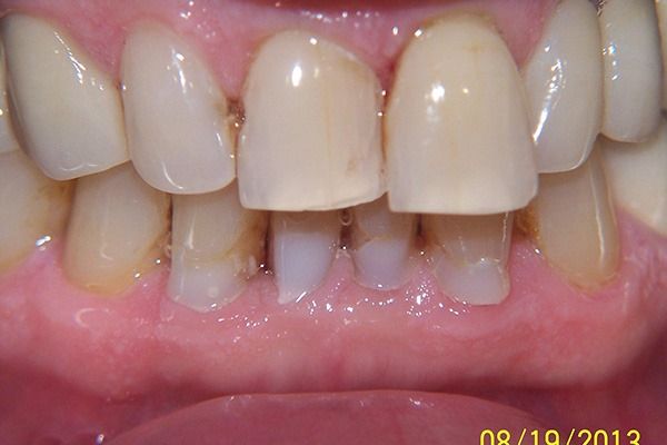 VSN Dental PC - Manalapan Information