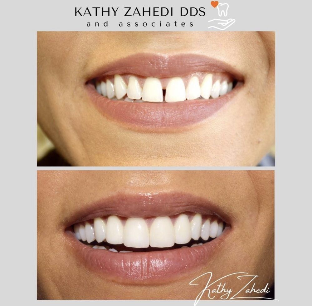 Kathy Zahedi, DDS & Associates - Santa Monica Combination
