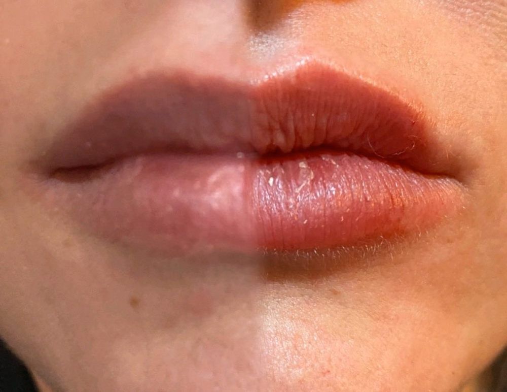 Le Joli Visage Med Spa - Granbury Thumbnails