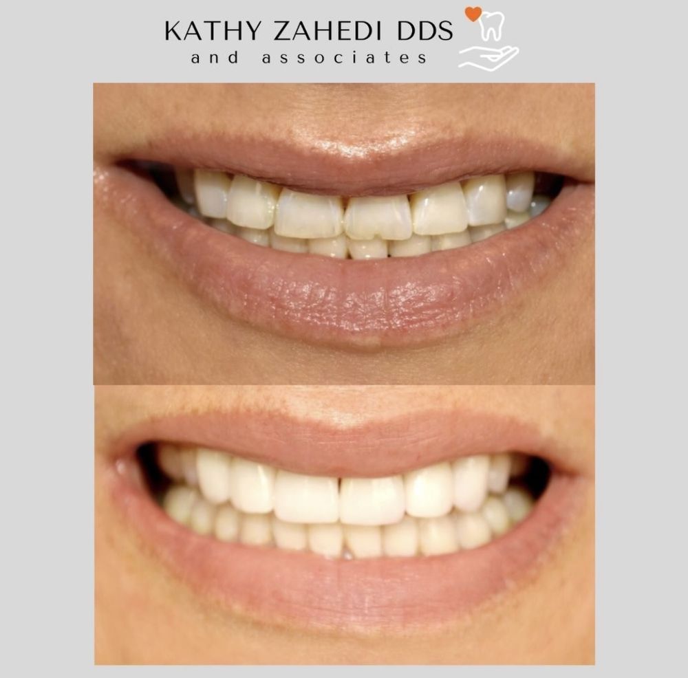 Kathy Zahedi, DDS & Associates - Santa Monica Appointment